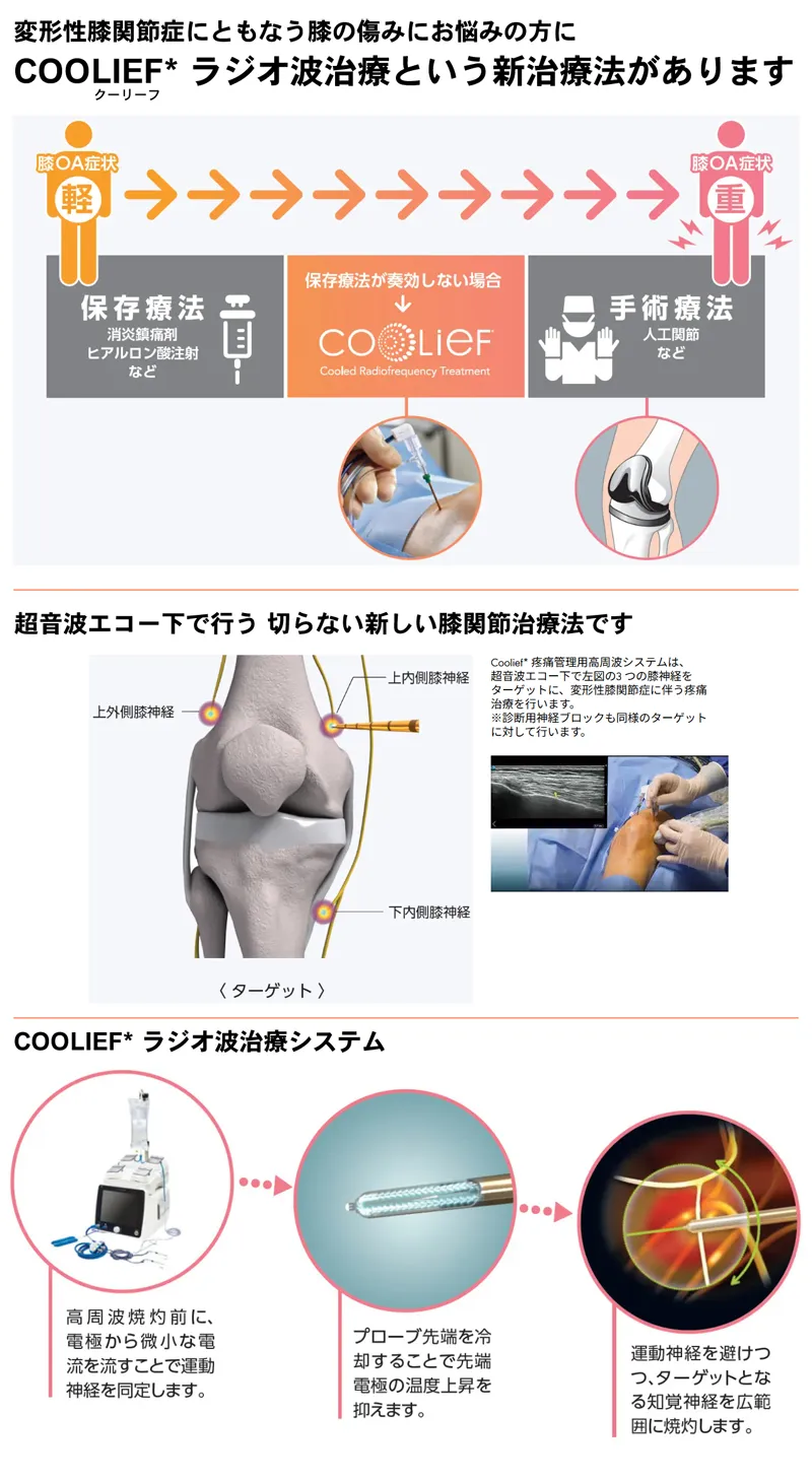 ひざの痛みに効果がある「Coolief(クーリーフ)ラジオ波治療」を導入しました